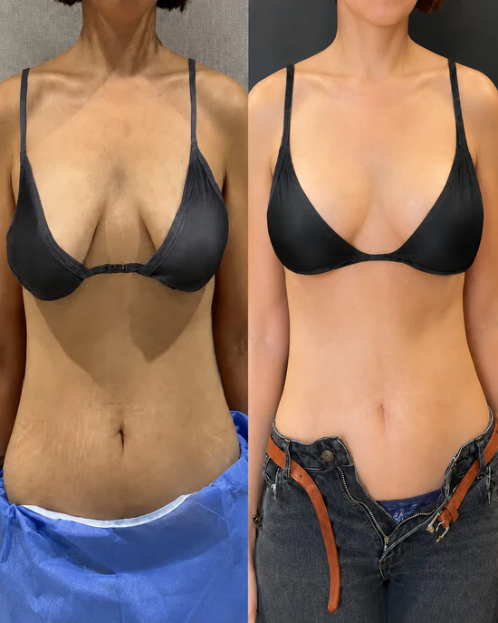 Customer result photo for Emily R.