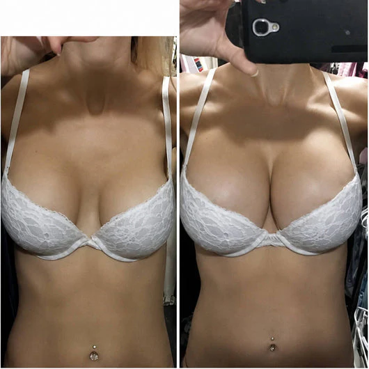 Customer result photo for Jessica T.