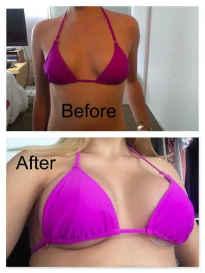 Customer result photo for Rachel K.